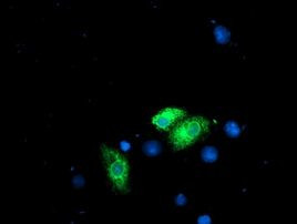 Ribophorin I Antibody in Immunocytochemistry (ICC/IF)