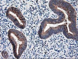 Ribophorin I Antibody in Immunohistochemistry (Paraffin) (IHC (P))