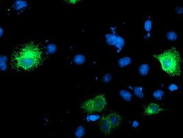 Ribophorin I Antibody in Immunocytochemistry (ICC/IF)