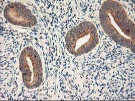 Ribophorin I Antibody in Immunohistochemistry (Paraffin) (IHC (P))