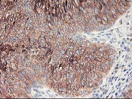 Ribophorin I Antibody in Immunohistochemistry (Paraffin) (IHC (P))