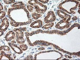 Ribophorin I Antibody in Immunohistochemistry (Paraffin) (IHC (P))