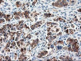 Ribophorin I Antibody in Immunohistochemistry (Paraffin) (IHC (P))