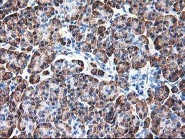 Ribophorin I Antibody in Immunohistochemistry (Paraffin) (IHC (P))