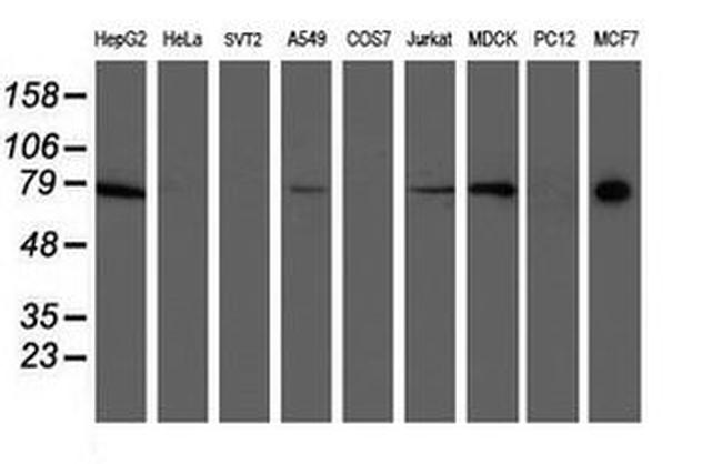 Ribophorin I Antibody in Western Blot (WB)