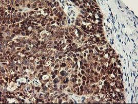 RbAp46 Antibody in Immunohistochemistry (Paraffin) (IHC (P))