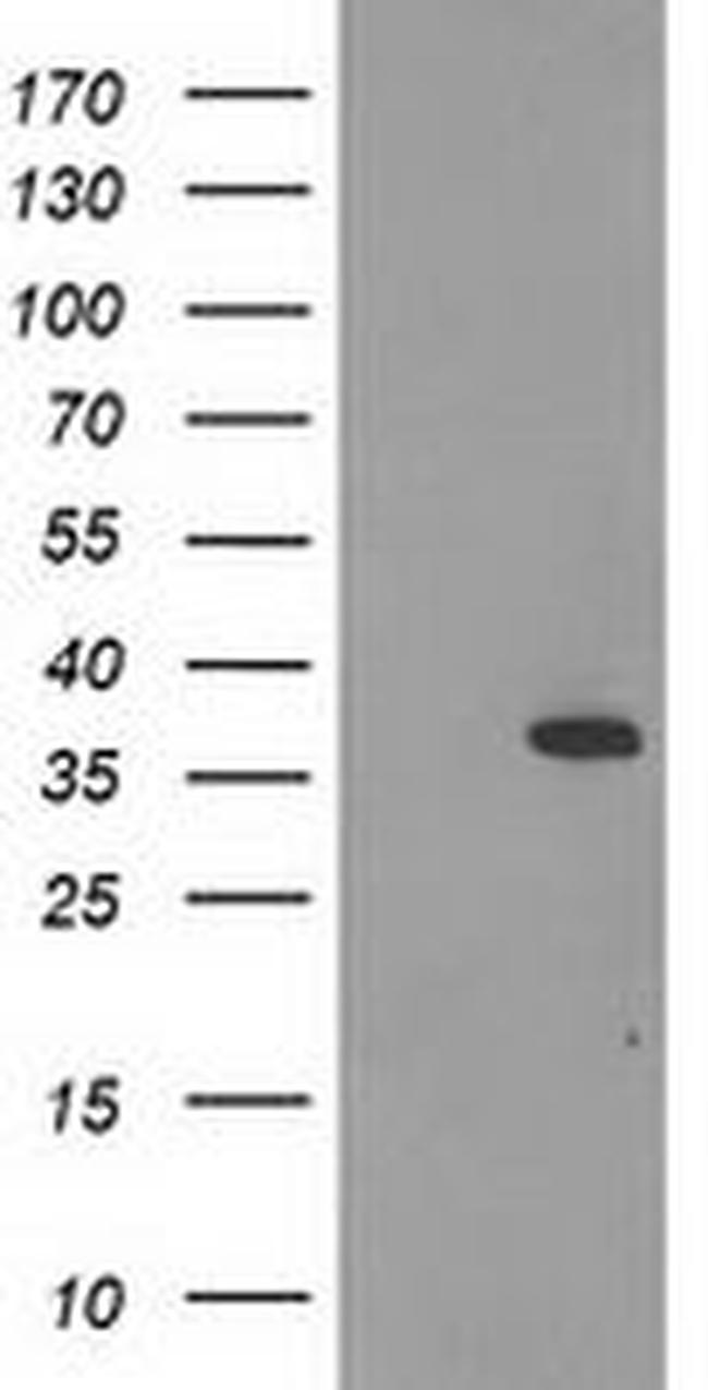 Calponin 2 Antibody in Western Blot (WB)