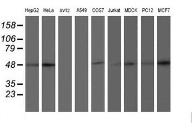 AIPL1 Antibody in Western Blot (WB)