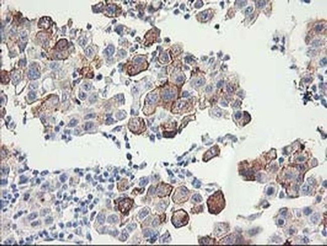 FAM119A Antibody in Immunohistochemistry (Paraffin) (IHC (P))