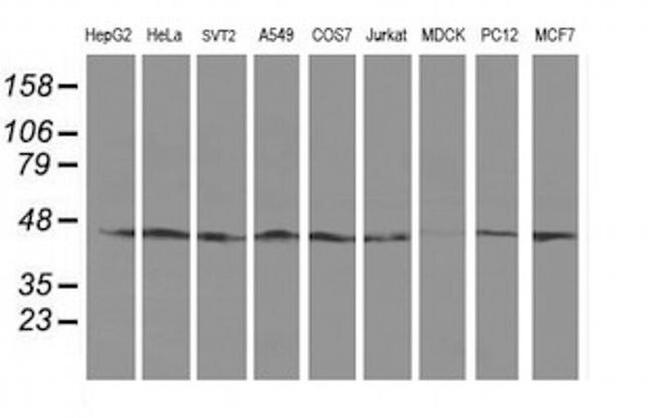 SERPINB13 Antibody in Western Blot (WB)