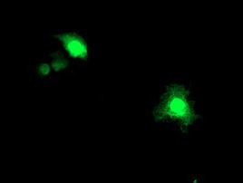 ASCC1 Antibody in Immunocytochemistry (ICC/IF)