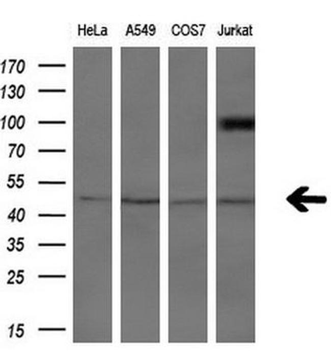 ASCC1 Antibody in Western Blot (WB)