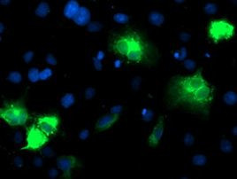 CYP2A6 Antibody in Immunocytochemistry (ICC/IF)