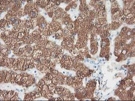 CYP2A6 Antibody in Immunohistochemistry (Paraffin) (IHC (P))