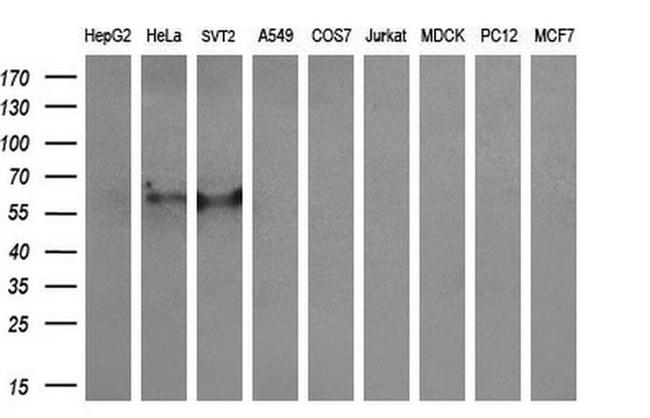 CYP2A6 Antibody in Western Blot (WB)