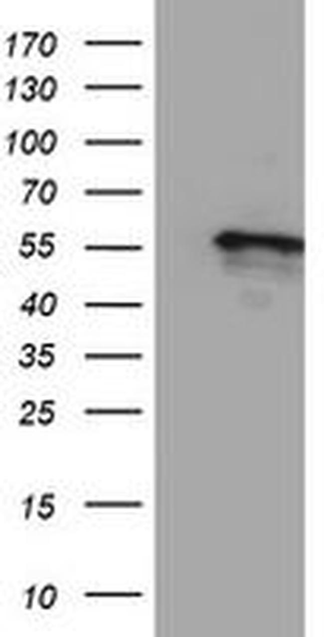 CYP2A6 Antibody in Western Blot (WB)