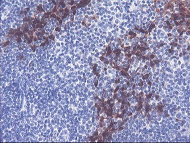 SERPINB2 Antibody in Immunohistochemistry (Paraffin) (IHC (P))