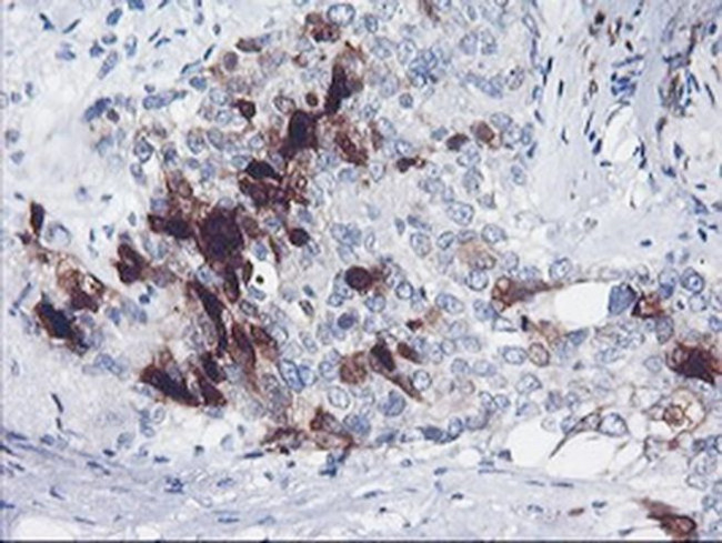 SERPINB2 Antibody in Immunohistochemistry (Paraffin) (IHC (P))