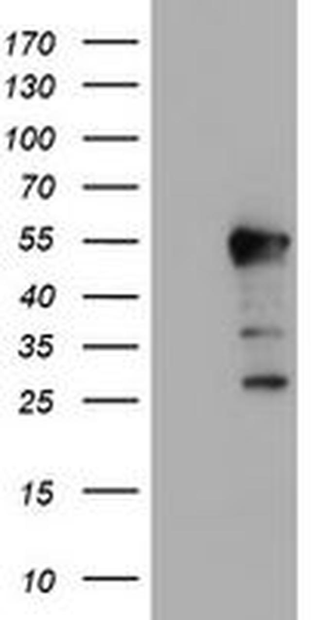 ERI1 Antibody in Western Blot (WB)