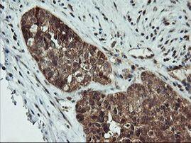 AGPAT5 Antibody in Immunohistochemistry (Paraffin) (IHC (P))