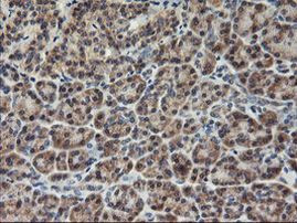 AGPAT5 Antibody in Immunohistochemistry (Paraffin) (IHC (P))