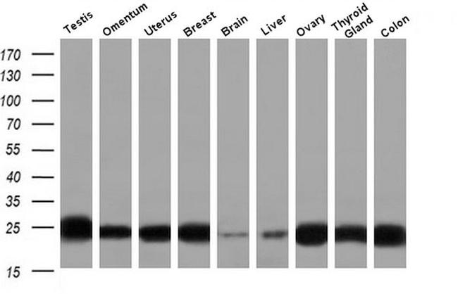 J Chain Antibody in Western Blot (WB)