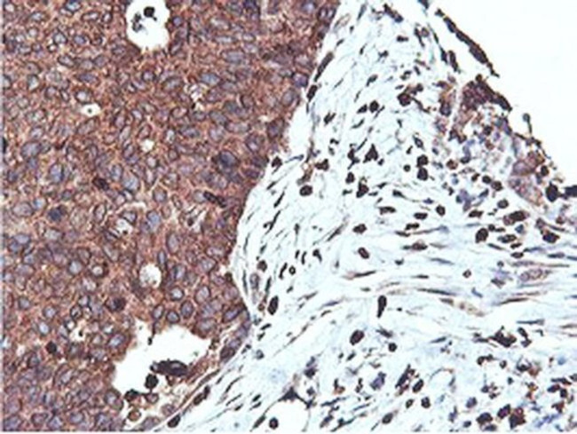 C20orf3 Antibody in Immunohistochemistry (Paraffin) (IHC (P))