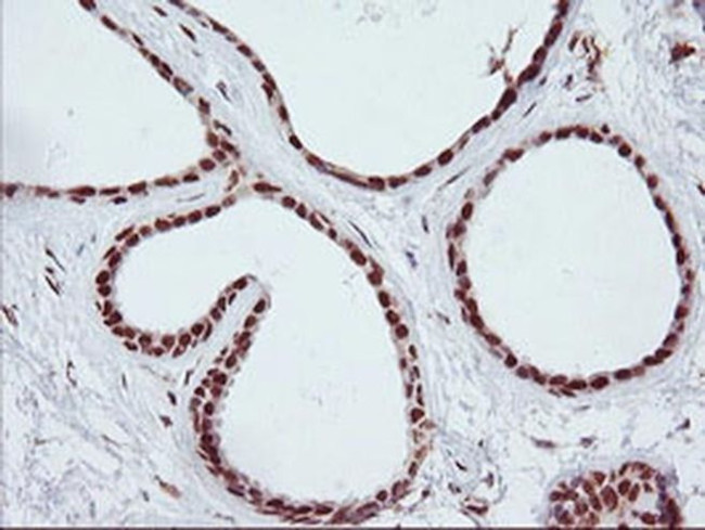 CD249 Antibody in Immunohistochemistry (Paraffin) (IHC (P))