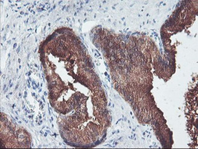 PECI Antibody in Immunohistochemistry (Paraffin) (IHC (P))