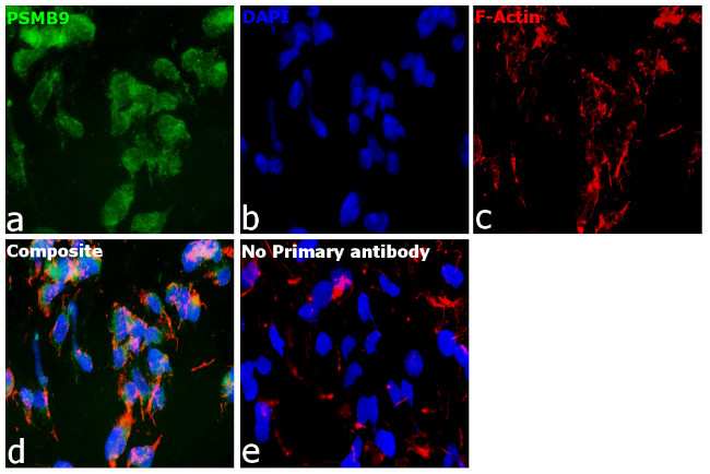 PSMB9 Antibody in Immunocytochemistry (ICC/IF)
