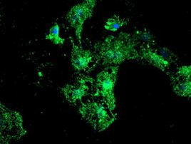 PSMB9 Antibody in Immunocytochemistry (ICC/IF)