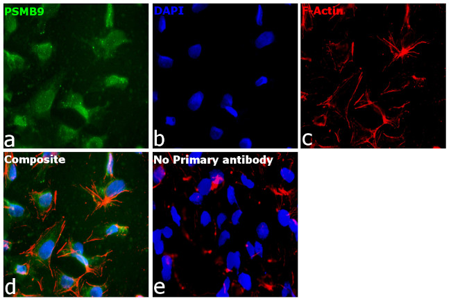 PSMB9 Antibody in Immunocytochemistry (ICC/IF)