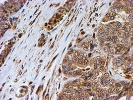 PSMB9 Antibody in Immunohistochemistry (Paraffin) (IHC (P))