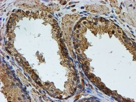 PSMB9 Antibody in Immunohistochemistry (Paraffin) (IHC (P))