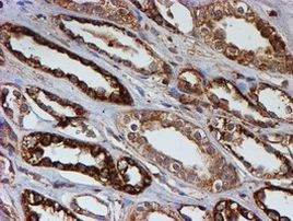 PSMB9 Antibody in Immunohistochemistry (Paraffin) (IHC (P))