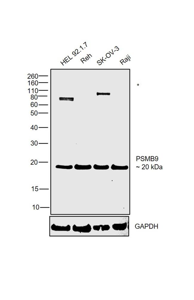 PSMB9 Antibody in Western Blot (WB)