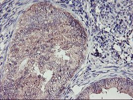 TMEFF2 Antibody in Immunohistochemistry (Paraffin) (IHC (P))