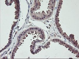 TMEFF2 Antibody in Immunohistochemistry (Paraffin) (IHC (P))