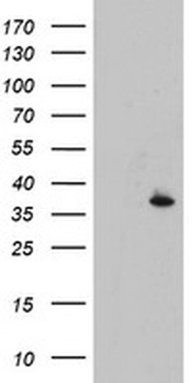 CYB5R1 Antibody in Western Blot (WB)