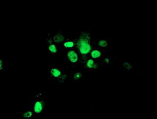 ATRIP Antibody in Immunocytochemistry (ICC/IF)