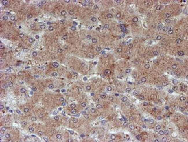 ATRIP Antibody in Immunohistochemistry (Paraffin) (IHC (P))