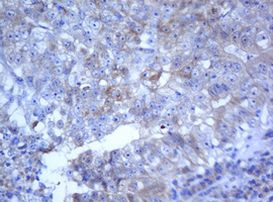 SELENBP1 Antibody in Immunohistochemistry (Paraffin) (IHC (P))