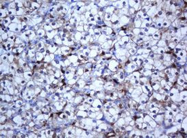 SELENBP1 Antibody in Immunohistochemistry (Paraffin) (IHC (P))