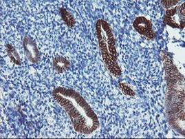 FXYD3 Antibody in Immunohistochemistry (Paraffin) (IHC (P))