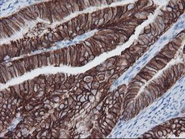 FXYD3 Antibody in Immunohistochemistry (Paraffin) (IHC (P))