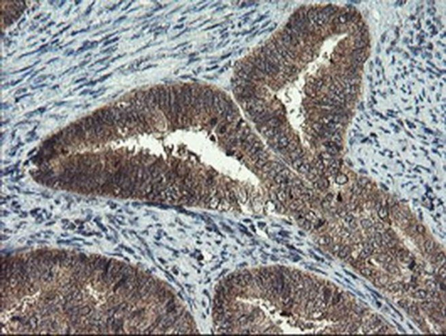 MLF1 Antibody in Immunohistochemistry (Paraffin) (IHC (P))