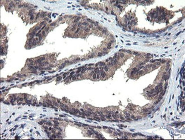 MLF1 Antibody in Immunohistochemistry (Paraffin) (IHC (P))