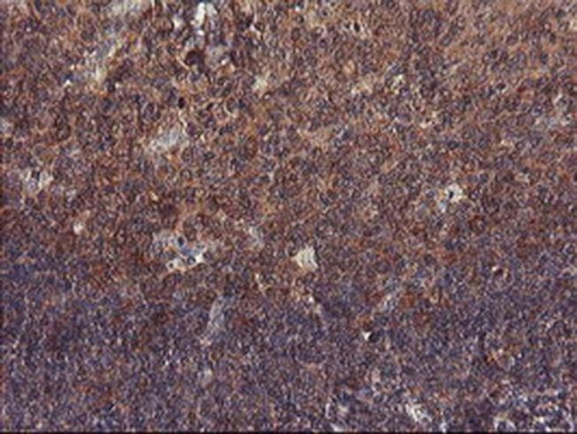 VBP1 Antibody in Immunohistochemistry (Paraffin) (IHC (P))