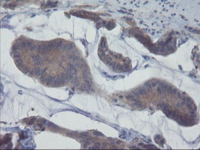 VBP1 Antibody in Immunohistochemistry (Paraffin) (IHC (P))