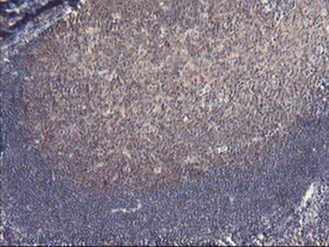 VBP1 Antibody in Immunohistochemistry (Paraffin) (IHC (P))